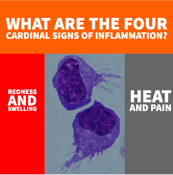 MIMR What are the four signs of an inflammation copy